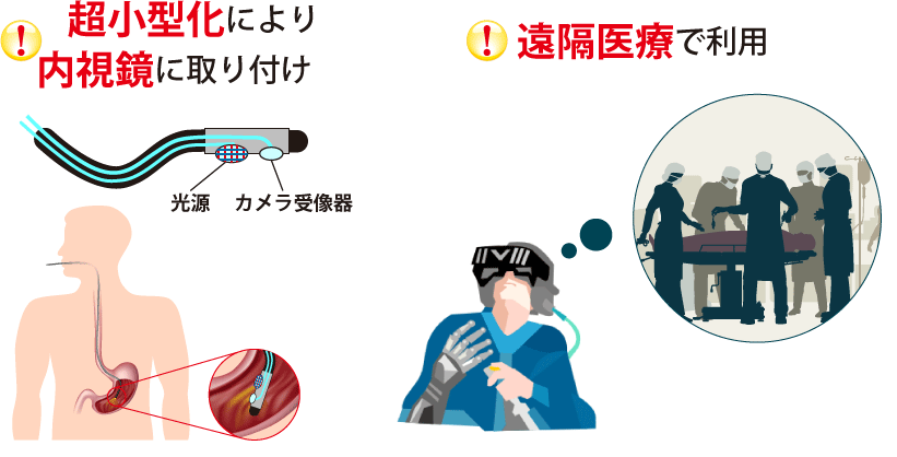 超小型化により内視鏡に取り付け　遠隔医療で利用